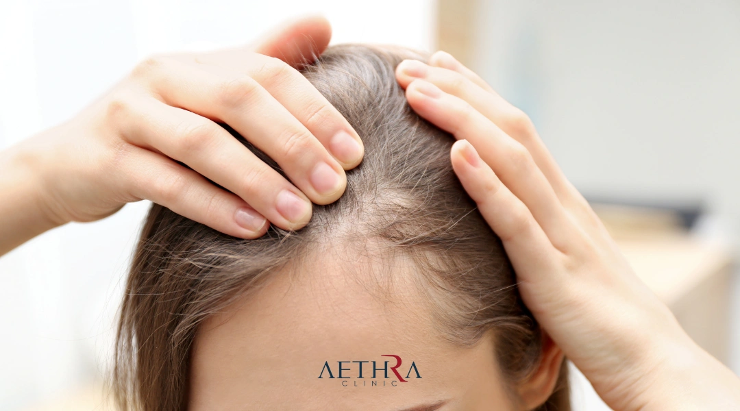 female hair transplant