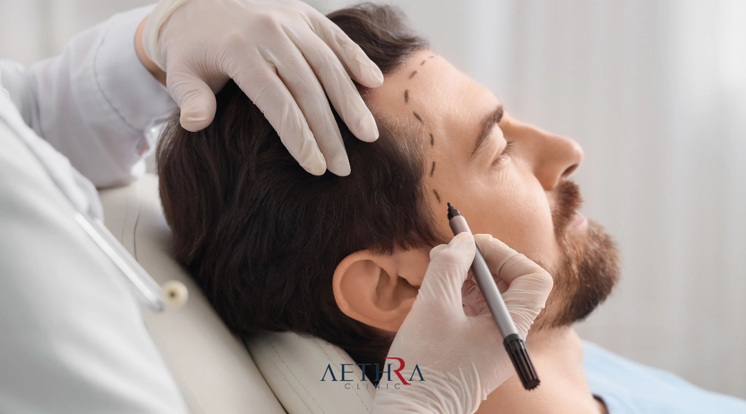 hair transplant slovakia