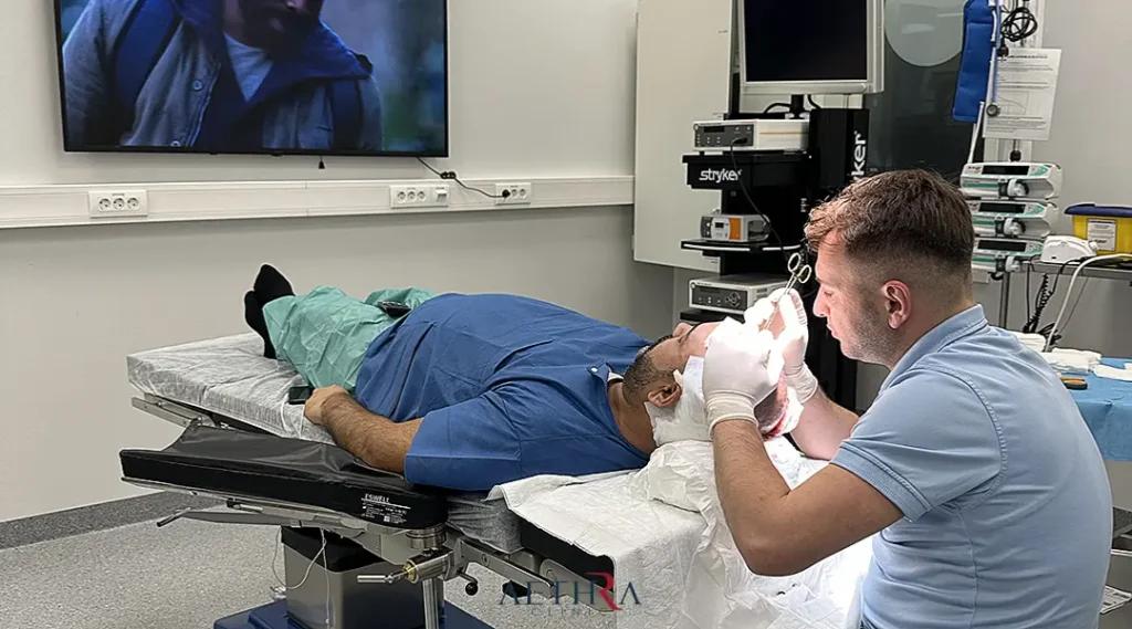 Hair Transplant in Kosice